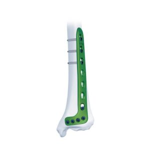 Placa Bloqueada Tibial Distal Lateral