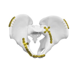 Placa Cuadrangular Superficie Posterior