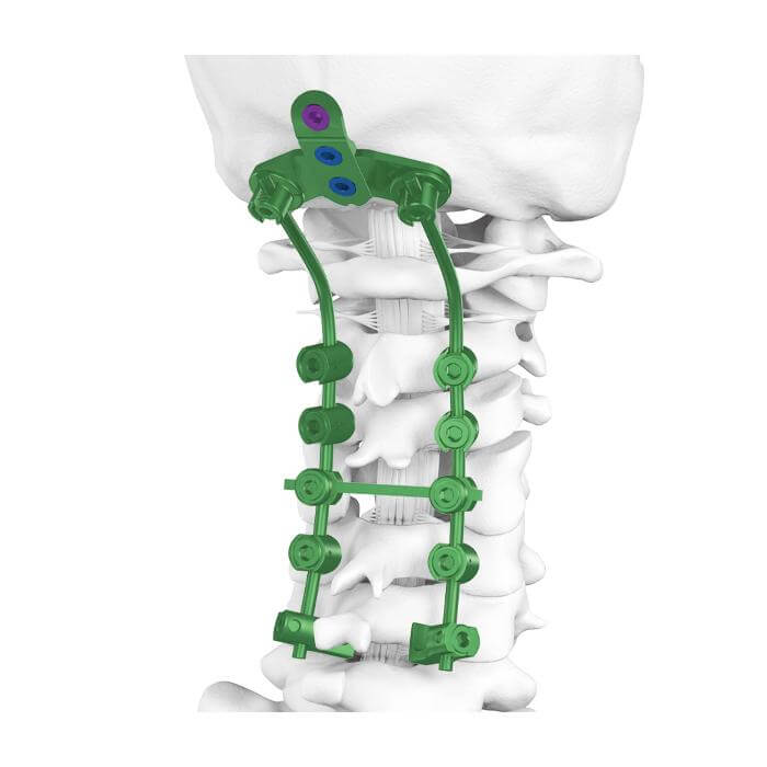 Prótesis de rodilla